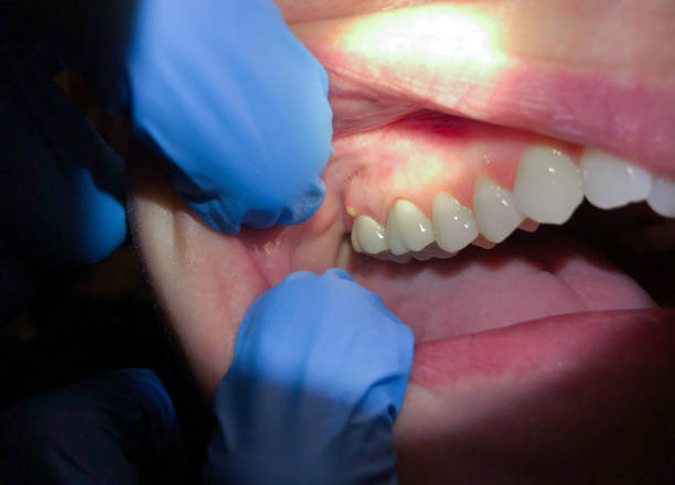 Best Broken or Chipped Tooth Repair in Kingfisher, OK