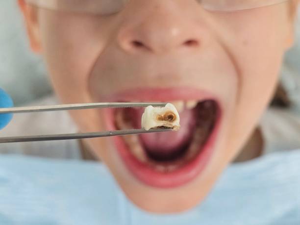 Best Emergency Cosmetic Dentistry (e.g., broken veneers) in Kingfisher, OK