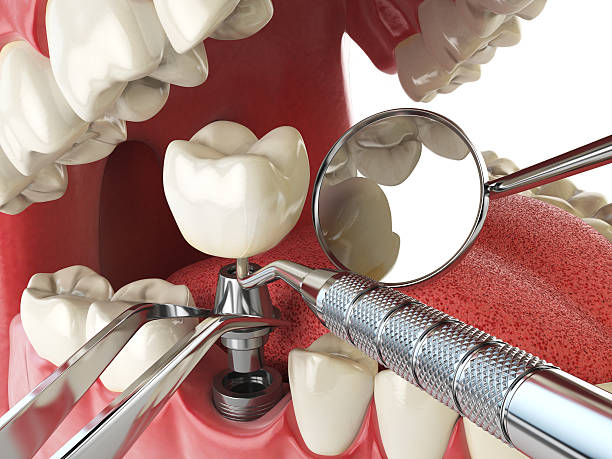 Best Emergency Dental Care for Sports Injuries in Kingfisher, OK